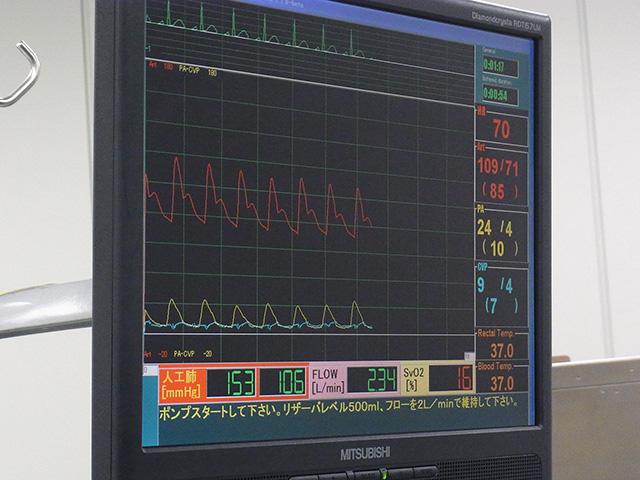 人工心肺シミュレーター／患者情報（心電図や血圧など）